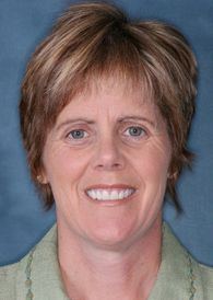 woman with nice smile from dental veneers